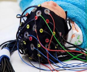 EEG-fNIRS多模態(tài)腦功能測(cè)試系統(tǒng)